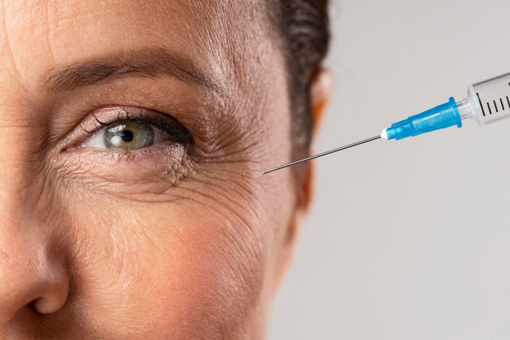 Reducir arrugas de expresión